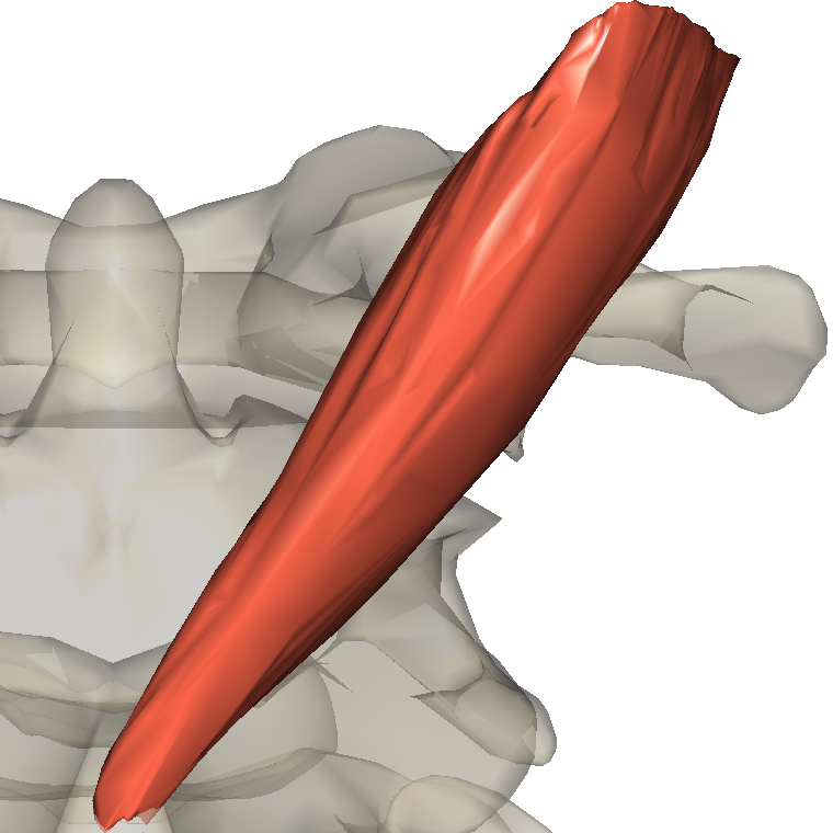 頭後大直肌 Rectus capitis posterior major的解剖位置圖