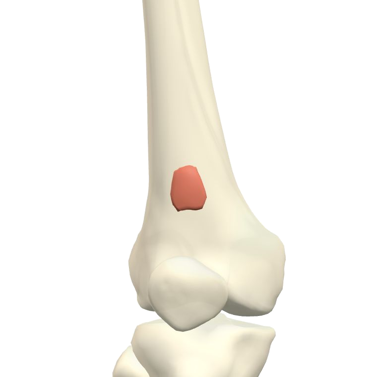 膝關節肌 Articularis genus的解剖位置圖